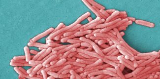 legionella pneumophila / sursa wikipedia.org