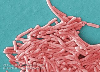 legionella pneumophila / sursa wikipedia.org