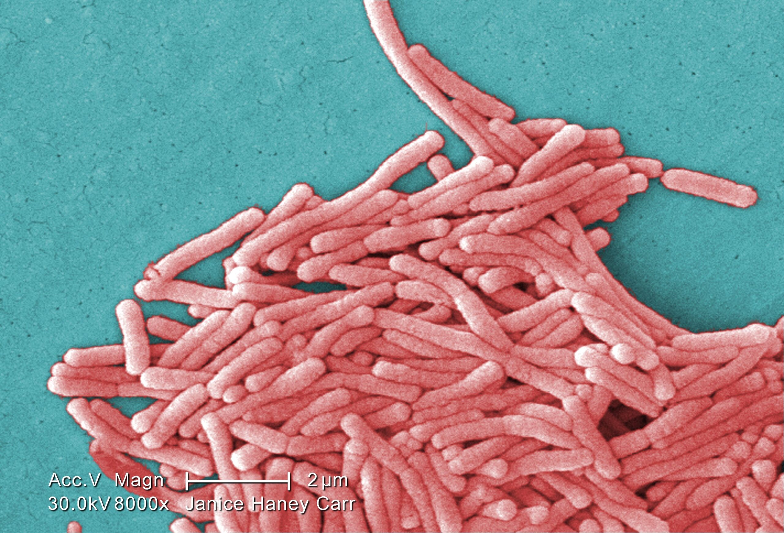 legionella pneumophila / sursa wikipedia.org