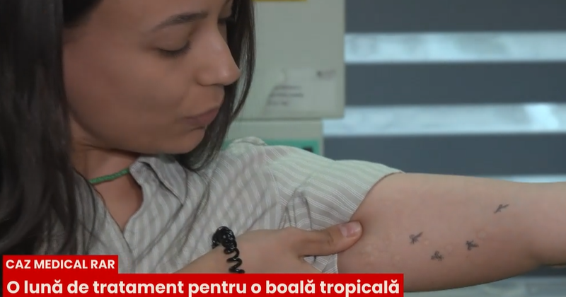 Leishmanioza captura tvr cluj